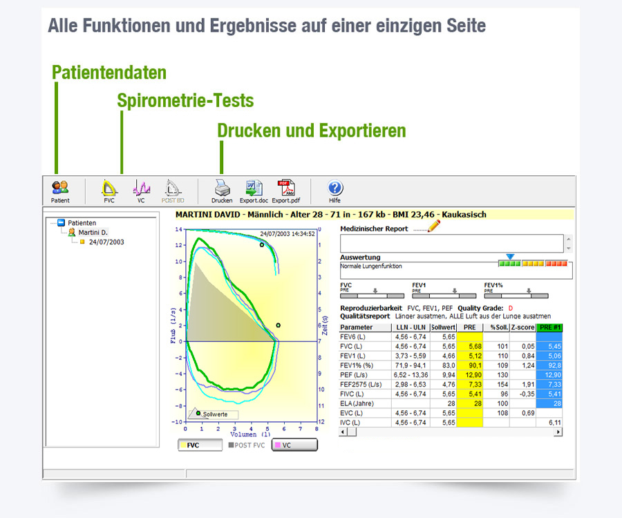 Minispir® New - computer-based spirometer for a complete analysis of the respiratory tract